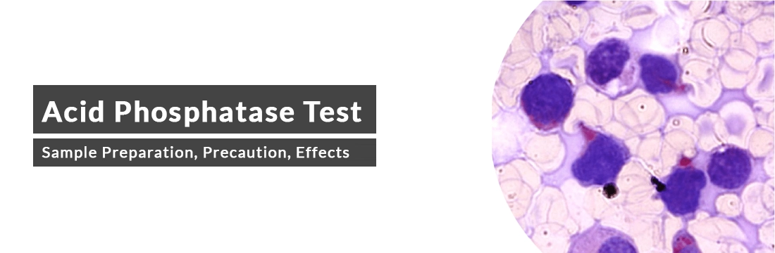  Acid Phosphatase Test: Sample Preparation, Precaution, Effects